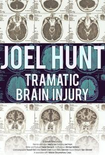 Joel Hunt: Traumatic Brain Injury (TBI)